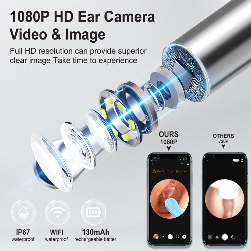 8-Piece Smart Visual Ear Cleaner, 1080P HD AI Warning, IP67 Waterproof Silicone Soft Tip, Safe and Comfortable Comfortable(black)